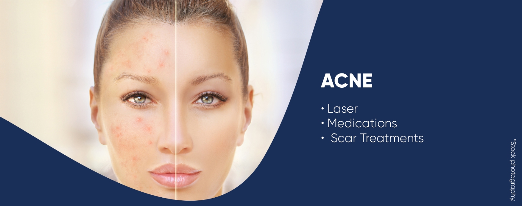 acne conditions and treatments banner